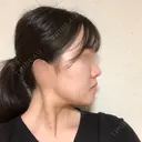 骨切り（あご） / 骨削り（エラ） / 骨削り（頬） RG整形外科（旧リオン整形外科） DAY 91 サムネイル用