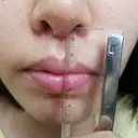 人中短縮 CLASSY 仙台美容外科・美容皮膚科 DAY 23 サムネイル用