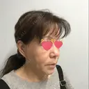 肌ヒアルロン酸注入（たるみ・シワ改善） ジョウクリニック 姫路院 DAY 56 サムネイル用