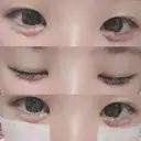 その他（目元） ばん皮膚科 DAY 4 サムネイル用