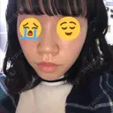 毛穴洗浄（ハイドラフェイシャルなど） 神成（こうせい）美容外科 DAY 6 サムネイル用