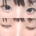 その他（目元） ばん皮膚科 DAY 5 サムネイル用