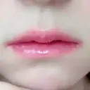 口唇縮小術 / PRP皮膚再生療法 品川美容外科 品川院 AFTER サムネイル用