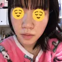 毛穴洗浄（ハイドラフェイシャルなど） 神成（こうせい）美容外科 DAY 9 サムネイル用