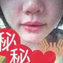 セットバック 大塚美容形成外科・歯科 大塚本院 DAY 81 サムネイル用