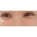 二重切開 CLASSY 仙台美容外科・美容皮膚科 DAY 43 サムネイル用