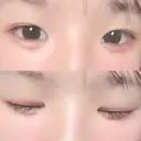 その他（目元） ばん皮膚科 DAY 11 サムネイル用