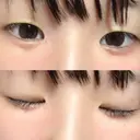 その他（目元） ばん皮膚科 DAY 12 サムネイル用