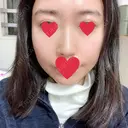 骨削り（頬） / 輪郭修正 マックスファクス銀座クリニック DAY 190 サムネイル用