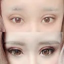 二重埋没 広島プルミエクリニック AFTER サムネイル用