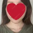 骨切り（あご） / 骨削り（エラ） / 脂肪注入（輪郭） RG整形外科（旧リオン整形外科） DAY 31 サムネイル用