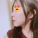 バッカルファット除去 / 脂肪吸引（顔） / ボトックス（エラ・小顔） / ヒアルロン酸注入（額） エートップ美容整形外科 DAY 318 サムネイル用