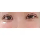 二重切開 CLASSY 仙台美容外科・美容皮膚科 DAY 47 サムネイル用