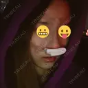 隆鼻術 / 鼻尖形成（切開） / 鼻中隔延長（切開） / 鼻孔縁挙上 ソウルリスタ整形外科 DAY 1 サムネイル用