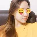 隆鼻術 / 鼻尖形成（切開） / 鼻中隔延長（切開） / 鼻孔縁挙上 ソウルリスタ整形外科 DAY 6 サムネイル用