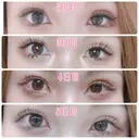 二重埋没 / 上まぶたの脂肪取り TCB東京中央美容外科 江坂院 DAY 6 サムネイル用