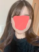 糸リフト / 骨切り（あご） / 骨削り（エラ） / 骨削り（頬） / 脂肪吸引（顔） RG整形外科（旧リオン整形外科） DAY 35 サムネイル用