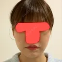 脂肪吸引（顔） / ボトックス（エラ・小顔） / 美容点滴・美容注射（美肌） エートップ美容整形外科 DAY 17 サムネイル用
