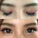 二重埋没 湘南美容歯科 大阪心斎橋院 DAY 4 サムネイル用