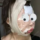 糸リフト / 骨削り（頬） / 脂肪吸引（顔） RG整形外科（旧リオン整形外科） DAY 0 サムネイル用