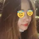 隆鼻術 / 鼻尖形成（切開） / 鼻中隔延長（切開） / 鼻孔縁挙上 ソウルリスタ整形外科 DAY 9 サムネイル用