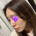 鼻尖形成（切開） / ヒアルロン酸注入（鼻） 東京ヒルズクリニック 新宿院 DAY 12 サムネイル用