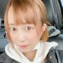 隆鼻術 / 鼻尖形成（切開） サラ美容外科 DAY 14 サムネイル用