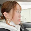 隆鼻術 / 鼻尖形成（切開） サラ美容外科 DAY 14 サムネイル用