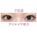 二重埋没 青山セレスクリニック 青山院 DAY 7 サムネイル用