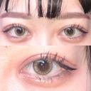 眼瞼下垂（切開） / その他（目元） / 目尻切開 / 自然癒着法 POP美容整形クリニック AFTER サムネイル用