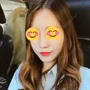 隆鼻術 / 鼻尖形成（切開） / 鼻中隔延長（切開） / 鼻孔縁挙上 ソウルリスタ整形外科 AFTER サムネイル用