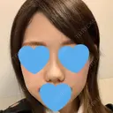 小鼻縮小（切開） / スレッドノーズ / ヒアルロン酸注入（鼻） キップン整形外科 DAY 7 サムネイル用