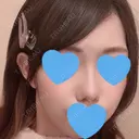 小鼻縮小（切開） / スレッドノーズ / ヒアルロン酸注入（鼻） キップン整形外科 DAY 32 サムネイル用