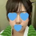 小鼻縮小（切開） / スレッドノーズ / ヒアルロン酸注入（鼻） キップン整形外科 DAY 11 サムネイル用