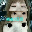 隆鼻術 城本クリニック 岡山院 DAY 3 サムネイル用
