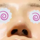 鼻修正 たにまちクリニック DAY 9 サムネイル用