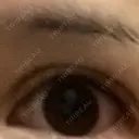 二重切開 牧野皮膚科形成外科内科医院 美容外科・形成外科・抗加齢医学外来 DAY 450 サムネイル用