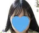 ボトックス（エラ・小顔） 品川スキンクリニック岡山院 DAY 16 サムネイル用