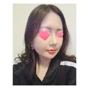 隆鼻術 / 鼻尖形成（切開） / 糸リフト / 骨削り（エラ） / 骨削り（頬） / 脂肪吸引（顔） RG整形外科（旧リオン整形外科） DAY 36 サムネイル用