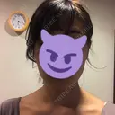 脂肪溶解注射（顔） / 美容点滴・美容注射（美肌） / ボトックス（肩） / ハイフ（顔） リエンジャン整形外科 江南店 DAY 5 サムネイル用