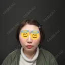 肌ヒアルロン酸注入（たるみ・シワ改善） / ボトックス（エラ・小顔） ジョウクリニック 姫路院 AFTER サムネイル用