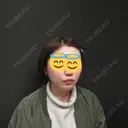 肌ヒアルロン酸注入（たるみ・シワ改善） / ボトックス（エラ・小顔） ジョウクリニック 姫路院 DAY 41 サムネイル用