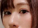 クマ治療 閉院｜プルージュ美容クリニック 赤羽院 DAY 30 サムネイル用