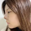 鼻中隔延長（切開） / 軟骨移植 / 眉間プロテーゼ FROM B整形外科 (旧バウム整形外科) DAY 4 サムネイル用