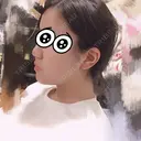 脂肪吸引（顔） 湘南美容クリニック 渋谷院 DAY 10 サムネイル用