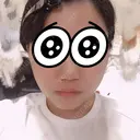脂肪吸引（顔） 湘南美容クリニック 渋谷院 DAY 10 サムネイル用