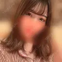 眼瞼下垂（切開） / 目尻切開 / タレ目形成・グラマラスライン（切開） プロミス整形外科 DAY 19 サムネイル用