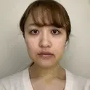 骨切り（あご） / 骨削り（エラ） ボンディ美容整形外科（旧リオン整形外科） DAY 7 サムネイル用