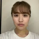 骨切り（あご） / 骨削り（エラ） ボンディ美容整形外科（旧リオン整形外科） DAY 8 サムネイル用