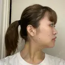 骨切り（あご） / 骨削り（エラ） ボンディ美容整形外科（旧リオン整形外科） DAY 8 サムネイル用